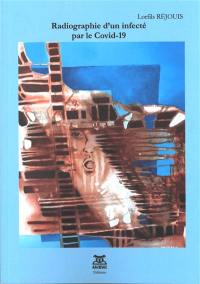 Radiographie d'un infecté par le Covid-19