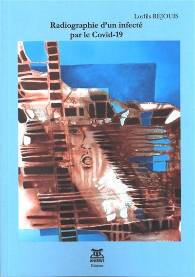 Radiographie d'un infecté par le Covid-19