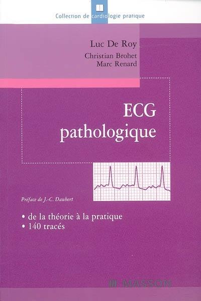 Marc Ries Ecg Livre : ECG pathologique : de la théorie à la pratique, 140 tracés, le ...