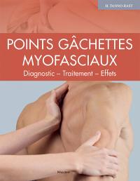 Points gâchettes myofasciaux : diagnostic, traitement, effets