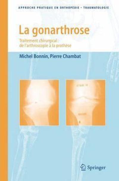 La gonarthrose La gonarthrose