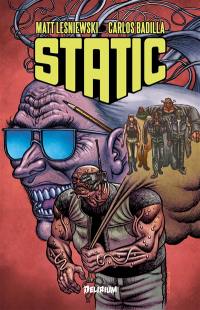 Static