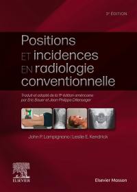 Positions et incidences en radiologie conventionnelle