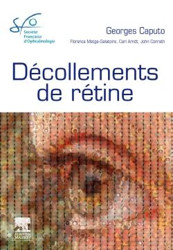 Décollements de rétine : rapport 2011 Décollements de rétine : rapport 2011